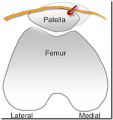 patellofemoral tape